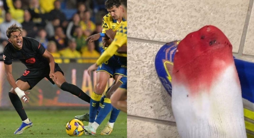 Barca nhận tin sét đánh về Lamine Yamal-597121
