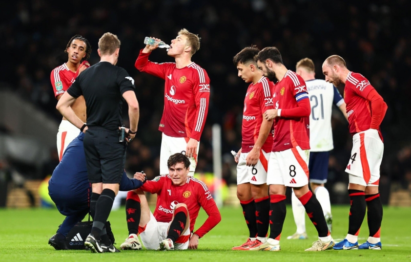 MU nhận thêm hung tin sau trận thua Tottenham 571961