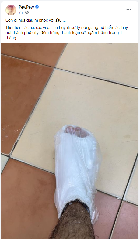 PewPew gãy chân trong khi đá bóng với độ mixi