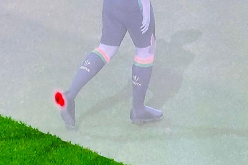 Bàn thắng việt bị bởi... đinh giày tại Serie A 573825