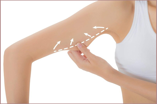 Massage giảm mỡ bắp tay