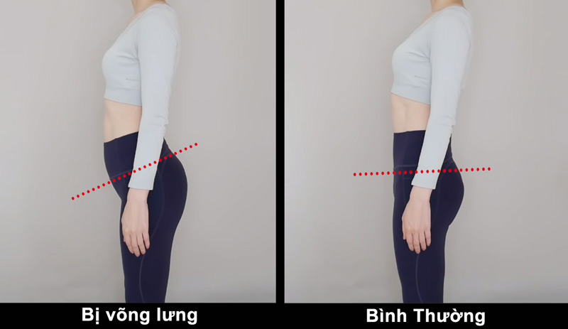 Võng lưng