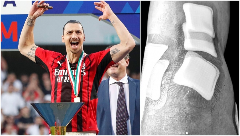Ibrahimovic chơi bóng mà không có dây chằng đầu gối suốt 6 tháng 141903