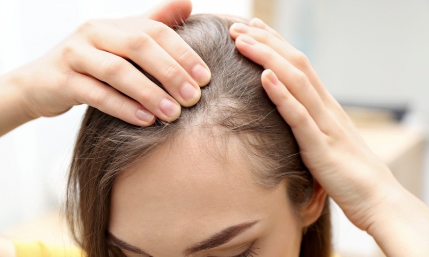 Nữ nên gội đầu mấy lần 1 tuần để có mái tóc khỏe đẹp? 377865