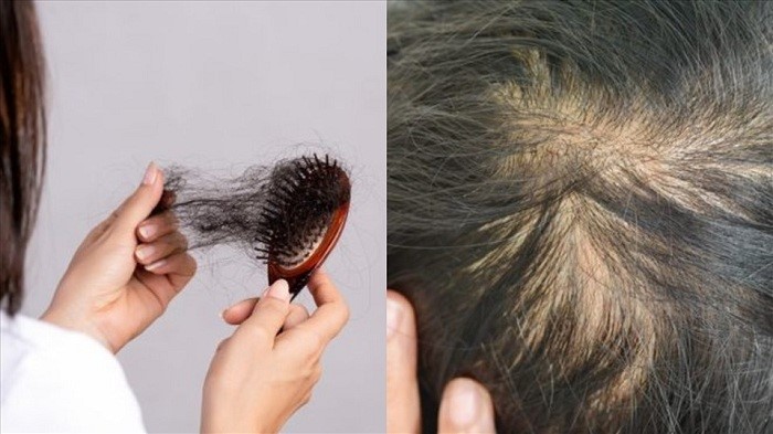 chọn dầu gội nữ theo tình trạng tóc 383073