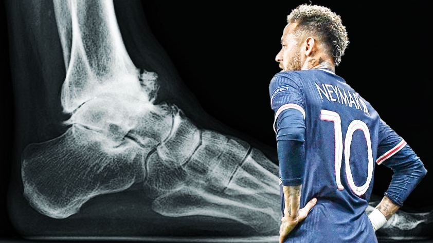 neymar-chan-thuong-psg-1680684742.jpg