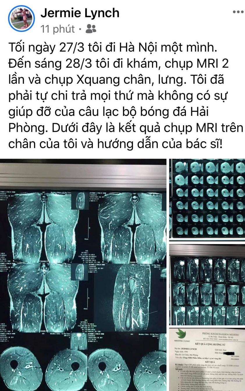 NÓNG: Ngoại binh Hải Phòng tố đang bị đe dọa Ảnh 1