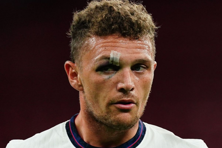 Trippier bi cam thi dau