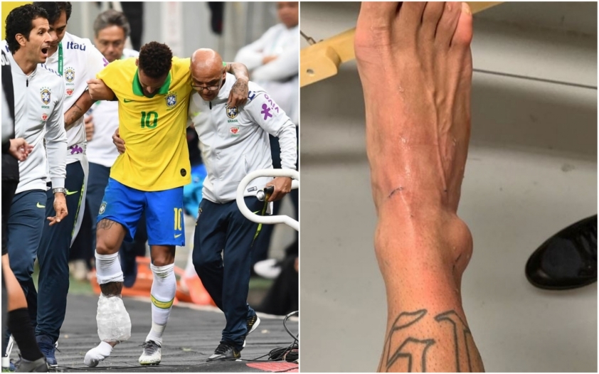 Neymar quấn băng cổ chân