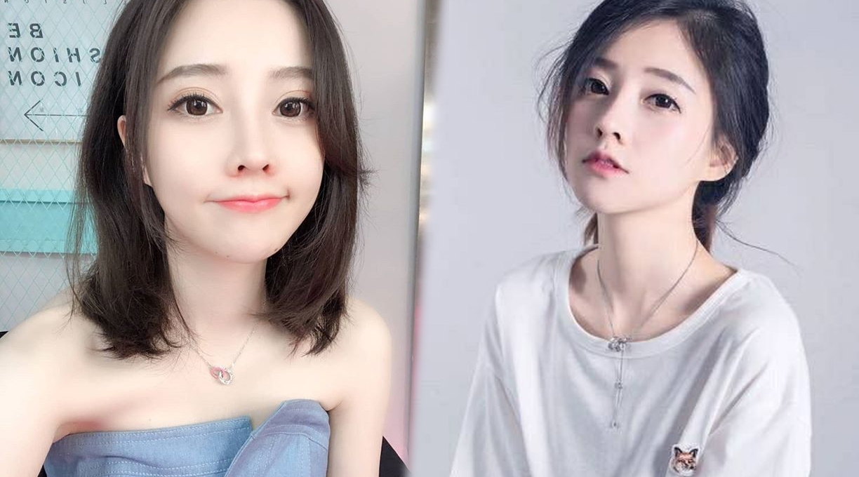 Nữ streamer Phùng Đề Mạc bị nghi phẫu thuật thẩm mỹ