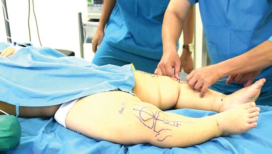 Những bài tập khắc phục chân vòng kiềng lâu năm hiệu quả nhất