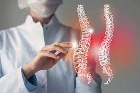 Võng lưng là gì? Các bài tập cải thiện võng lưng tại nhà