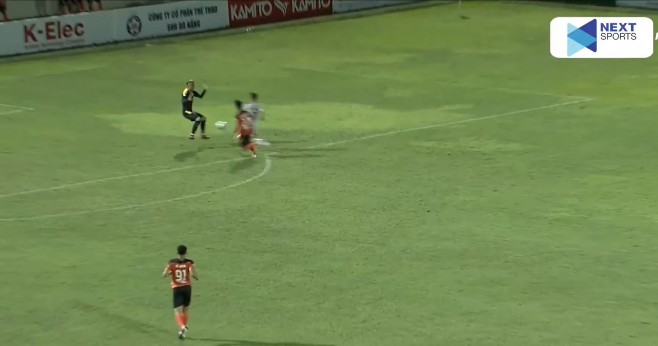 Thanh Bình bị gãy chân, nghỉ hết mùa giải V-League 2022