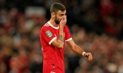 Bị chỉ trích chơi tệ, Bruno Fernandes được phán quyết tương lai tại Man Utd