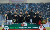 HAGL mất trụ cột, Công Phượng tiếp tục phải dự bị ở vòng 2 V-League?