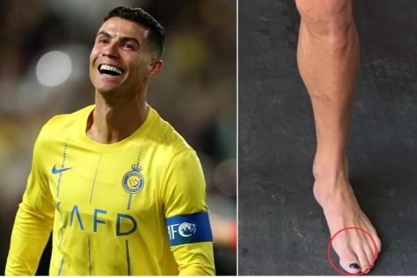 Lý do Cristiano Ronaldo và Mike Tyson đua nhau sơn móng