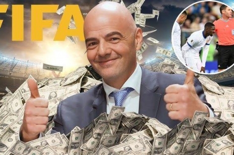 Sếp lớn bóng đá Pháp chỉ trích FIFA vì kiếm tiền bất chấp sức khỏe cầu thủ