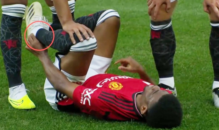 Sao Man United chấn thương tồi tệ, nguy cơ bỏ lỡ cả mùa giải?