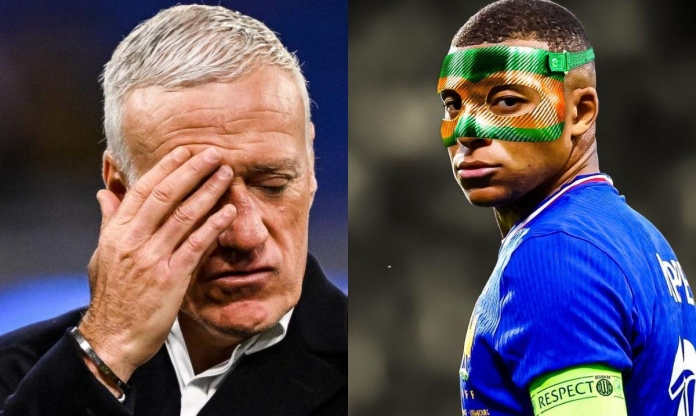 Chính thức: Deschamps xác nhận Mbappe phải phẫu thuật
