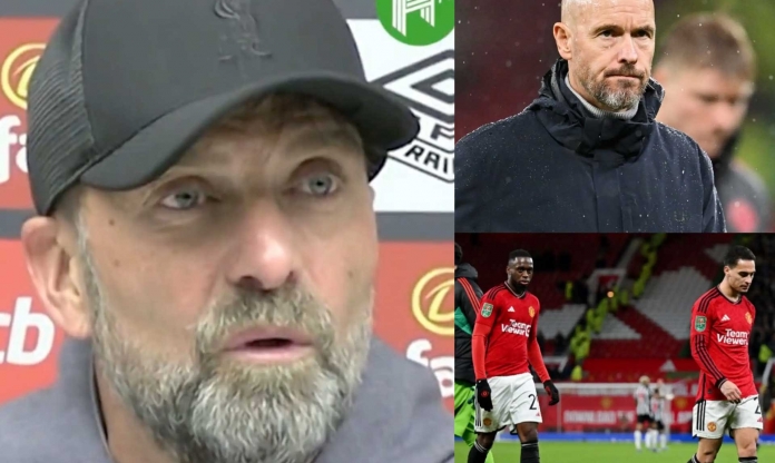 Biết tin MU thua thảm, biểu cảm hài hước của HLV Liverpool gây sốt khắp mạng xã hội
