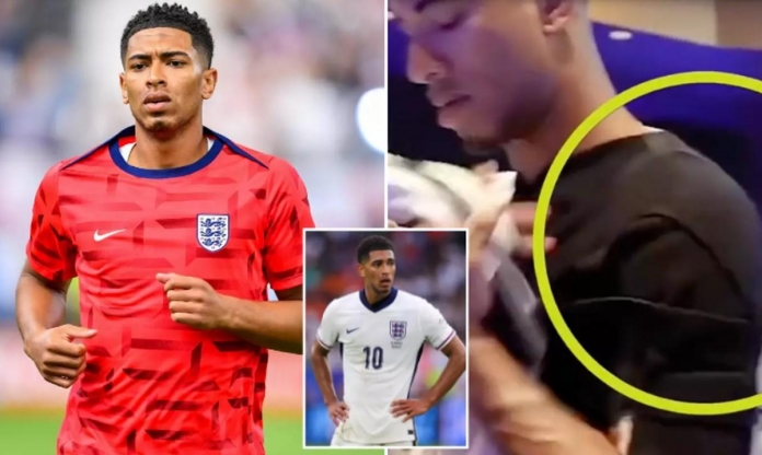 Jude Bellingham và miếng đệm vai kỳ lạ tại Euro 2024