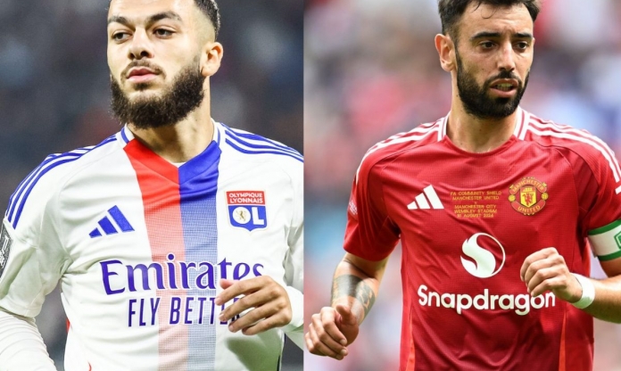 Nhận định Lyon vs MU: Quỷ đỏ 'trầy da tróc vẩy'