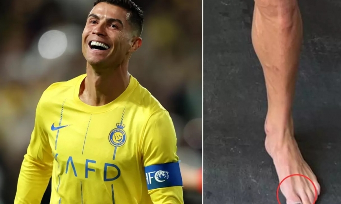 Ronaldo gây sốt vì sơn móng chân như con gái, ngủ trưa 5 lần một ngày