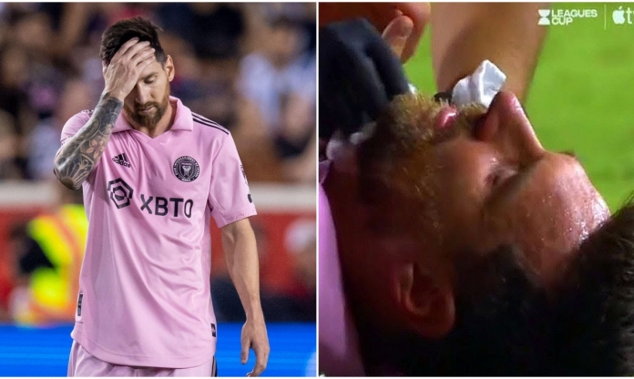 Bước vào 'chảo lửa', Inter Miami công bố luôn tình trạng của Messi