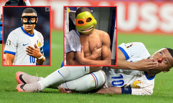 Mbappe xin ý kiến CĐM về 'trang bị' cho trận tới tại Euro 2024