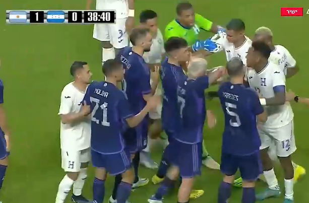 Video: Cầu thủ Argentina 'ăn tươi' đối thủ vì vào bóng thô bạo với Messi