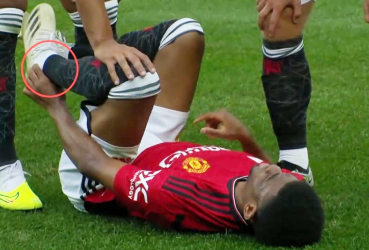 Sao Man United chấn thương tồi tệ, nguy cơ bỏ lỡ cả mùa giải?