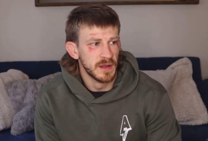 Võ sĩ UFC bị đánh bầm tím vì... không biết nói tiếng Pháp