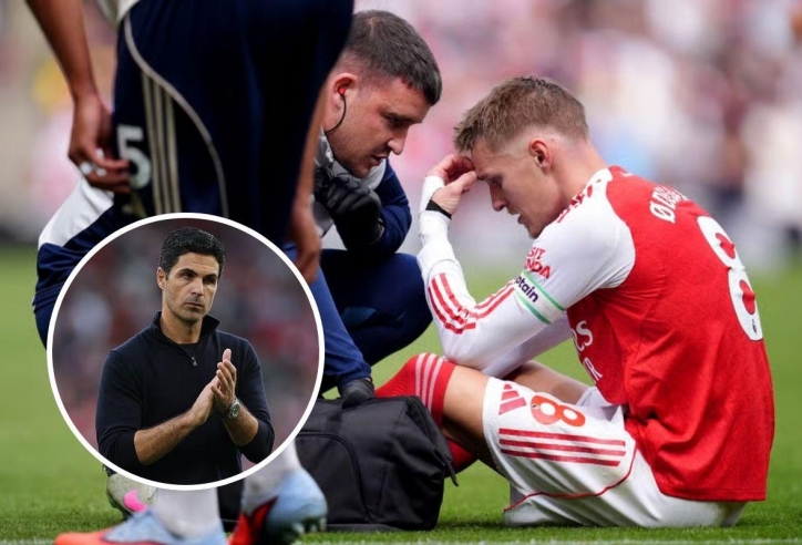 Arteta tiết lộ tin không vui về thủ lĩnh Arsenal trước thềm C1