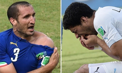 Luis Suarez: 21 Euro nếu cắn Pepe và 51 Euro nếu cắn Ronaldo