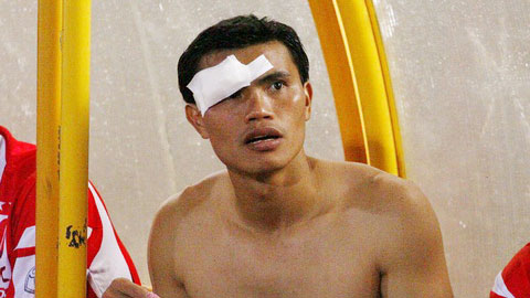Tài Em phải khâu 6 mũi sau trận hòa 1-1 SLNA
