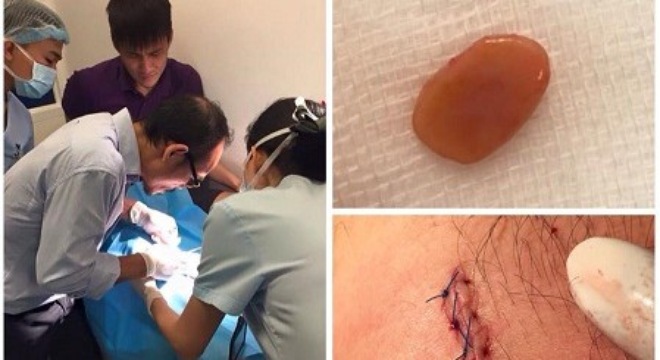 Công Vinh trực tiếp quan sát bác sĩ mổ đầu gối