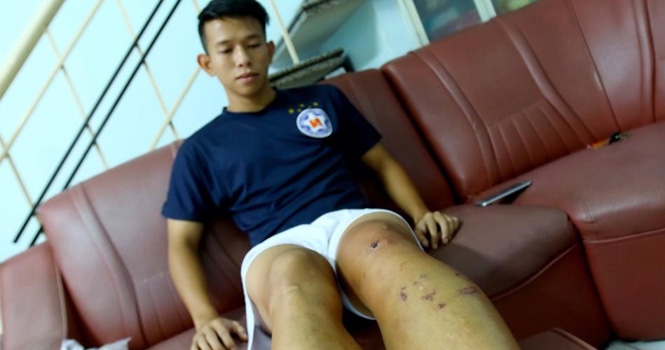 Sốc: Quế Ngọc Hải phải chi đến 1 tỷ đồng viện phí cho Anh Khoa