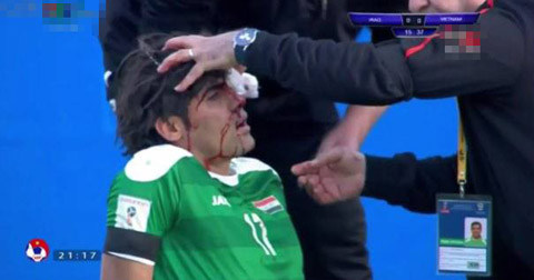 Hậu vệ của ĐT Iraq nhập viện, thở ô xy sau khi đấu ĐT Việt Nam