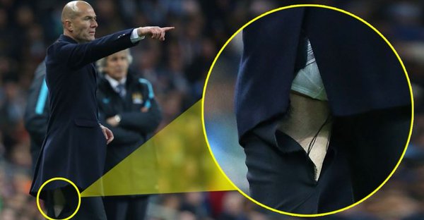VIDEO: Zidane tái diễn tình cảnh bị rách quần ở trận gặp Man City