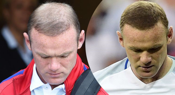 VIDEO: Rooney hói trở lại sau trận Anh thua Iceland