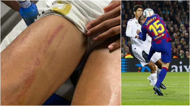 Bằng chứng Varane bị trung vệ Barca 'chặt chém' tơi tả