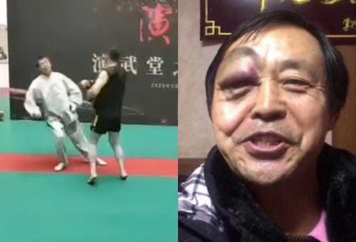 Thua võ sĩ nghiệp dư, cao thủ Thái cực đổ cho bị trúng độc