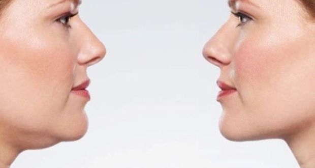 Cách giảm béo mặt và cằm tự nhiên hiệu quả