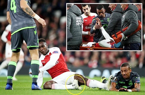 SỐC: Welbeck có thể nghỉ bóng đá vì chấn thương