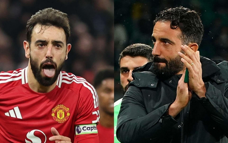 HLV Ruben Amorim: 'Hôm nay MU đá hay hơn nhưng vẫn thua'