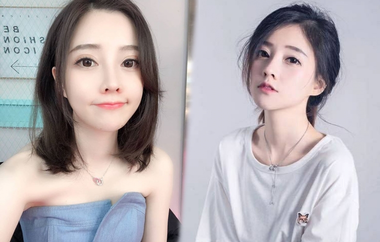 Nữ streamer Phùng Đề Mạc bị nghi phẫu thuật thẩm mỹ