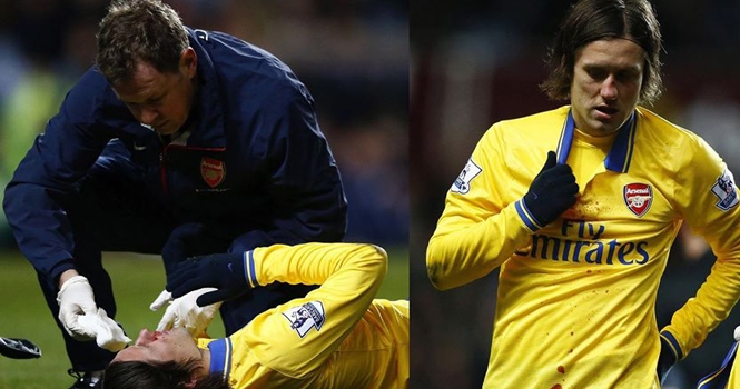 Bị vỡ mũi, Rosicky vắng mặt tại trận gặp Fulham