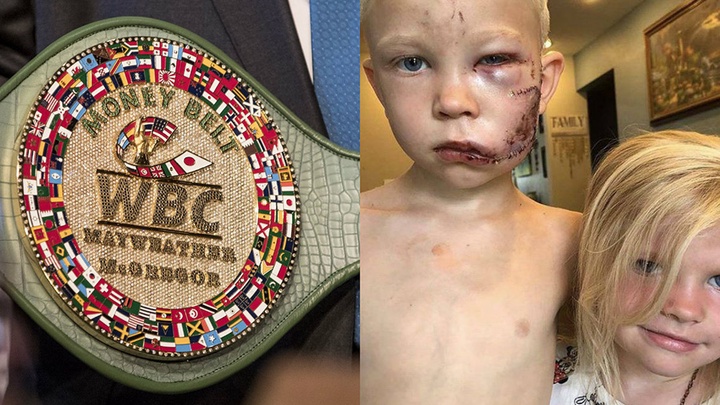 Cậu bé 6 tuổi đánh bại chó dữ cứu em nhận đai vô địch Boxing thế giới