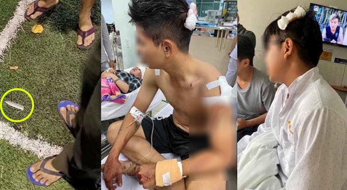 Cầu thủ phủi Việt Nam bị đánh trọng thương, phải nhập viện cấp cứu
