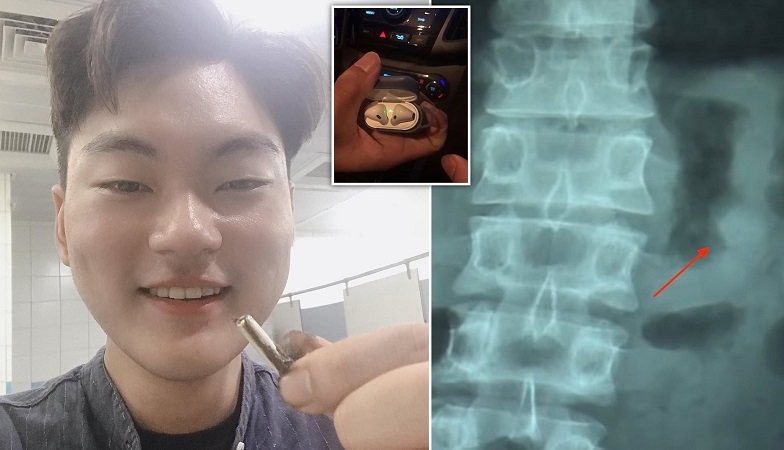 Airpod vẫn dùng tốt sau khi bị nuốt vào bụng